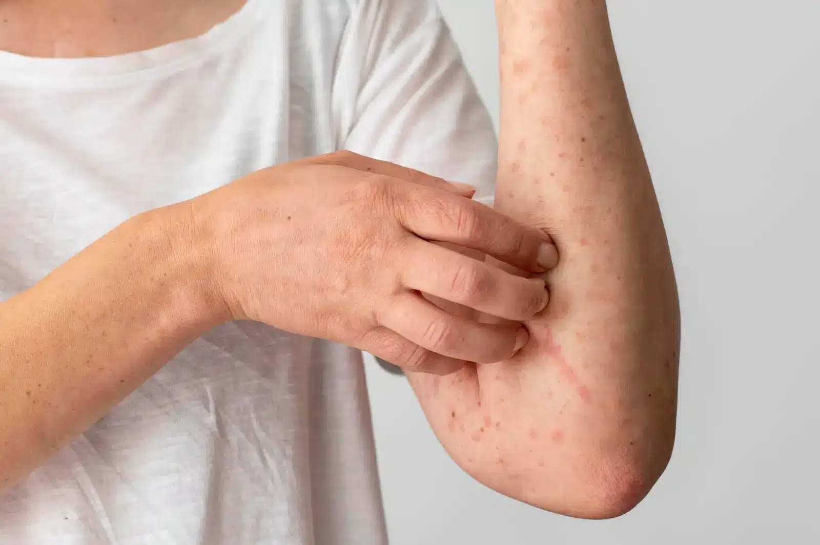 Person with itch.