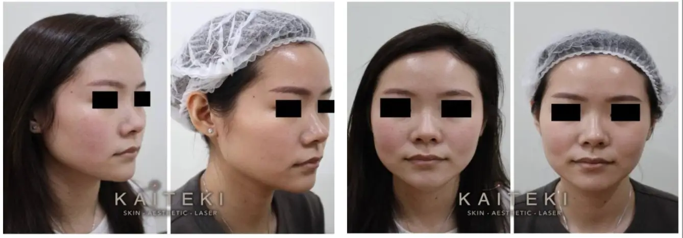 Before and After Case Studies 1