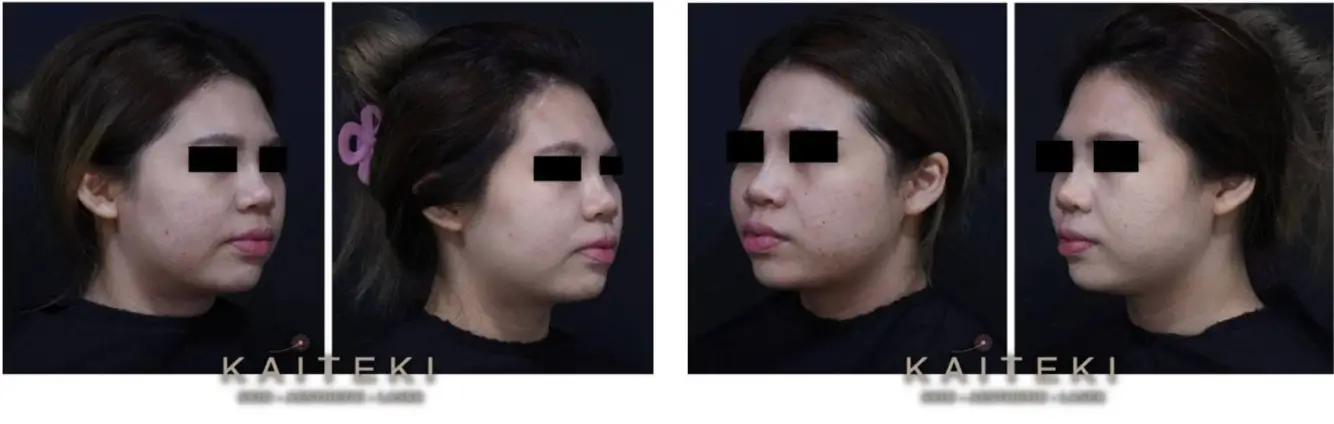 Before and After Case Studies 2