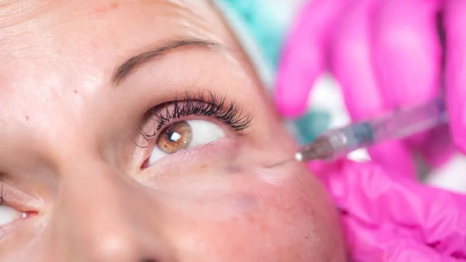Person injecting the eye.