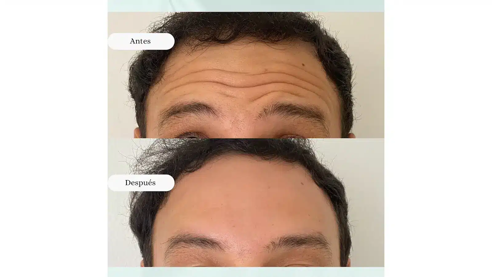 Before and after picture of a person. 