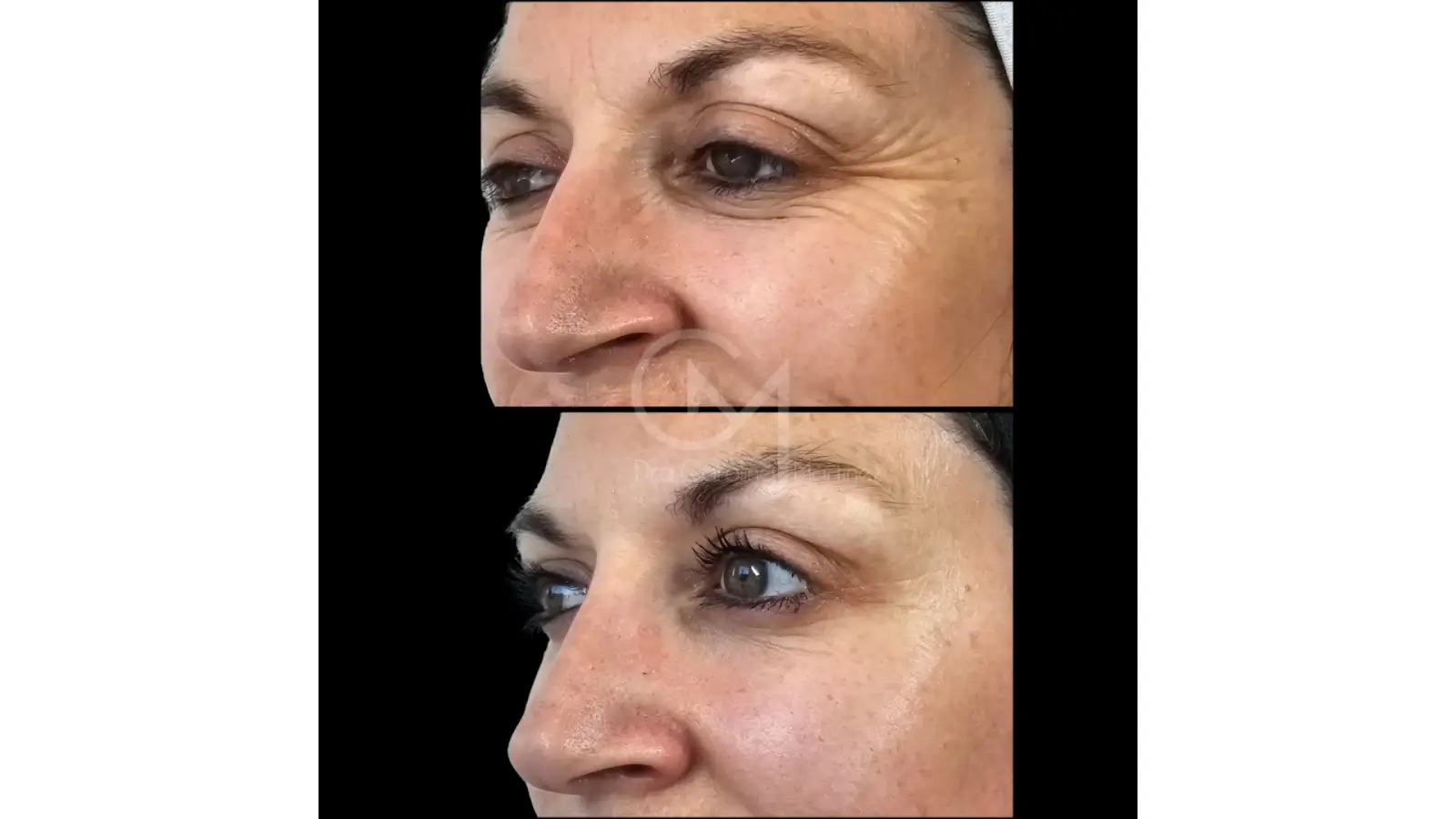 Before and after picture of a person. 