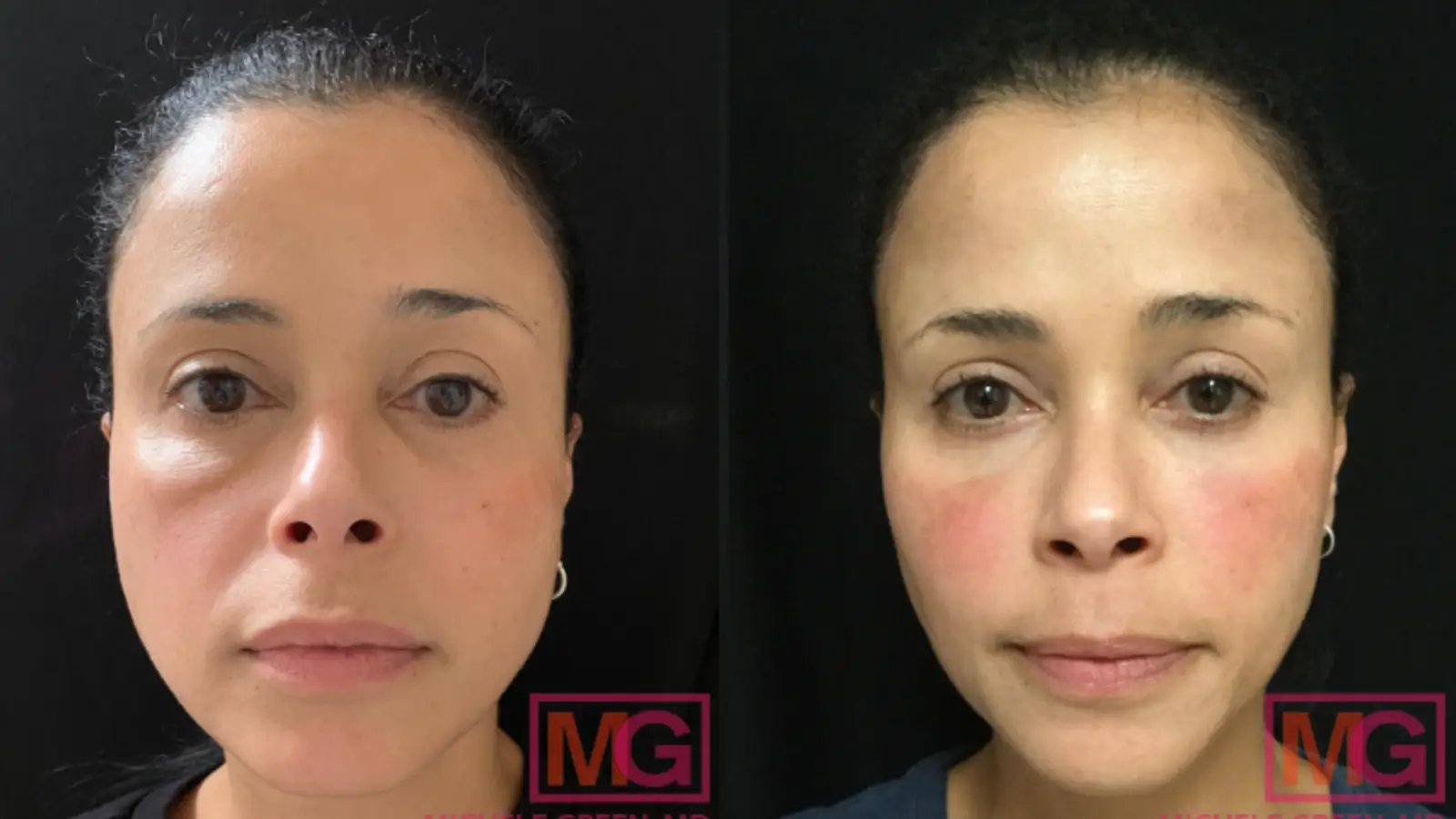 Person who used the treatment.