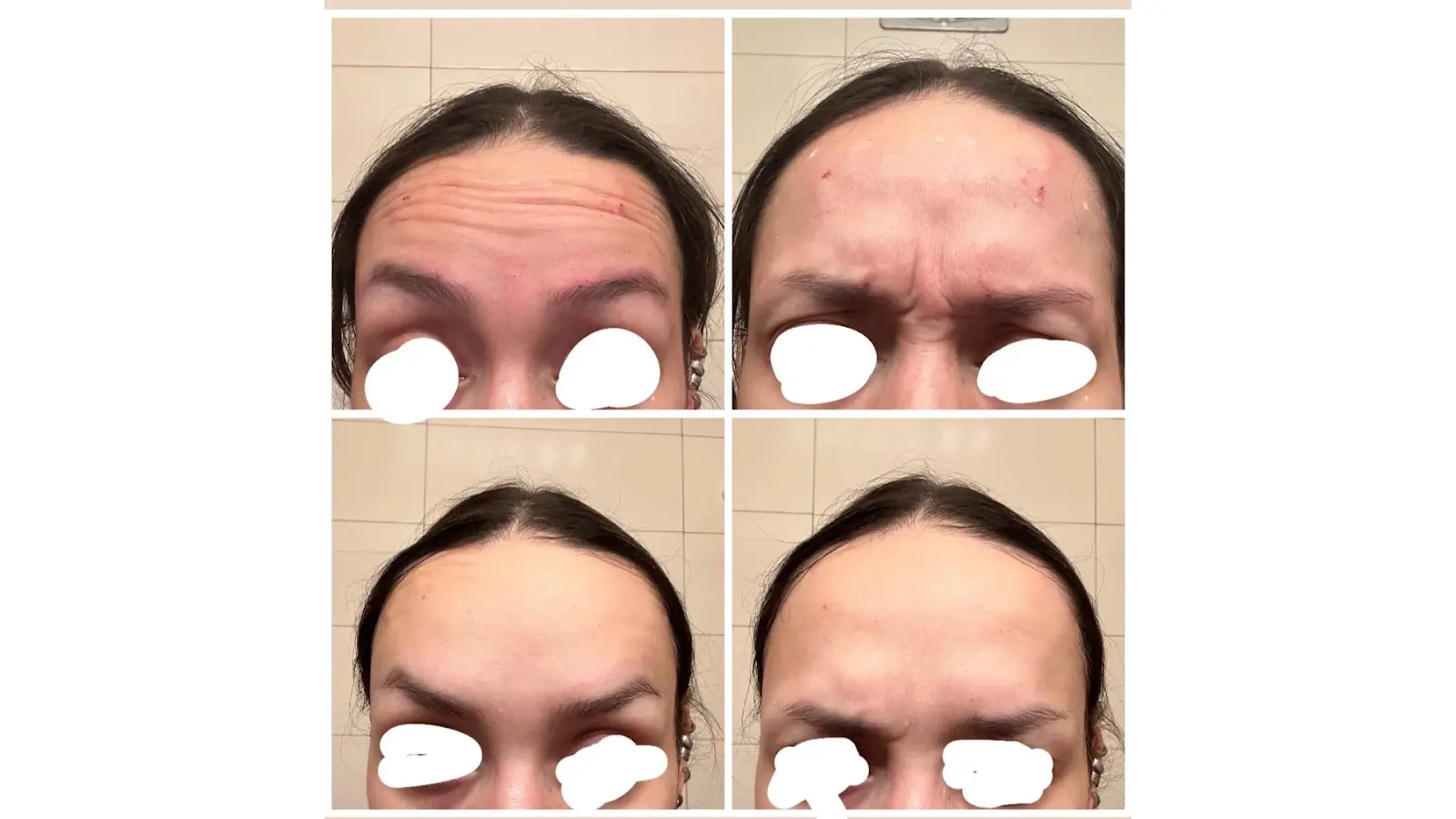 Before and after of person.