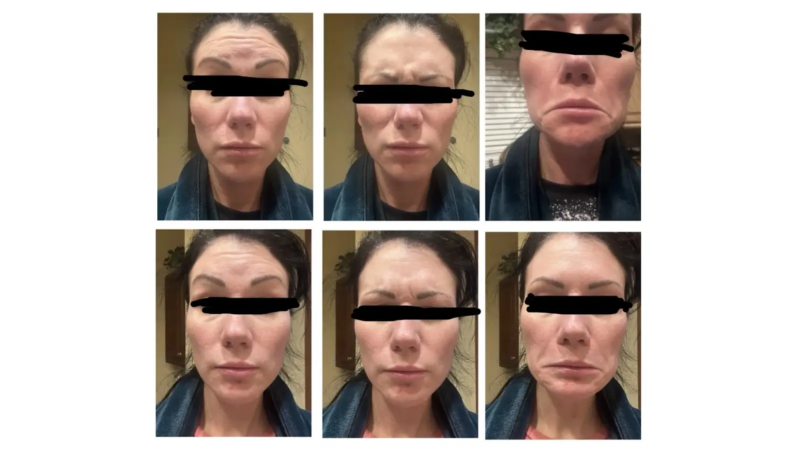 Before and after of person who underwent treatment. 